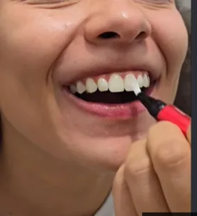 Detalhe real de dentes e gengiva para avaliação de sensibilidade